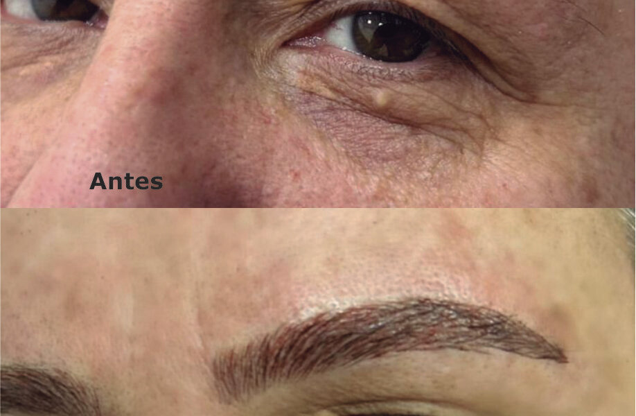 Sobrancelhas com Microblading
