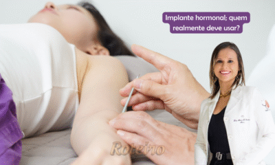 Dra. Adriana Oliveira, especialista do Instituto Luvany em São José dos Campos, realiza procedimento de implante hormonal em paciente. Imagem com texto de título: 'Implante hormonal; quem realmente deve usar?